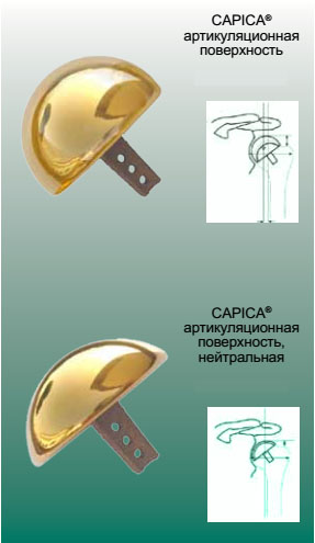 CAPICA® система замещения артикуляционной поверхности головки плечевой кости