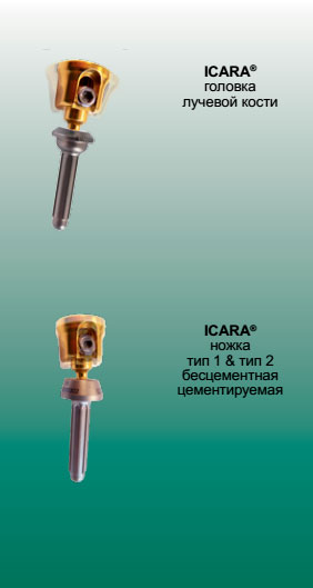 ICARA® эндопротез для замещения головки лучевой кости