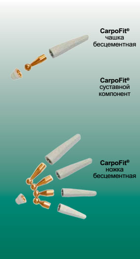 CarpoFit® имплантат запястно-пястного сустава I — го пальца