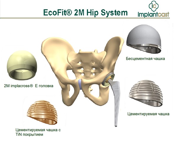EcoFit® 2M система эндопротезирования тазобедренного сустава